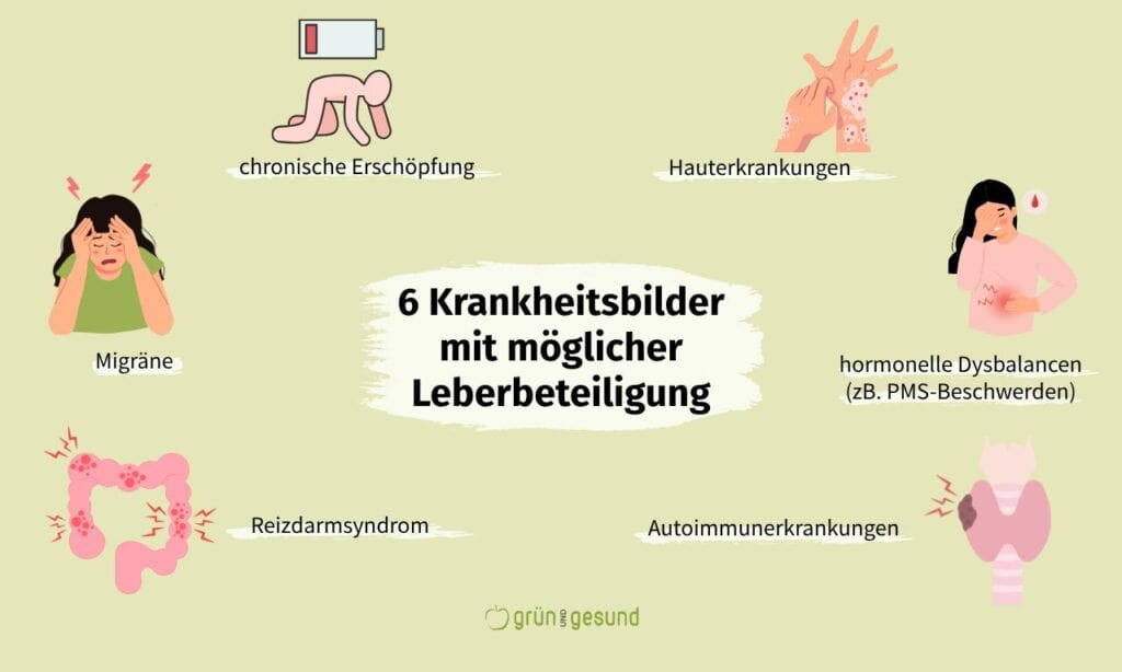 typische krankheitsbilder einer ueberlasteten leber